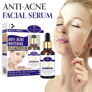 Aichun beauty Anti Acne Whitening Facial Serum 30 ML